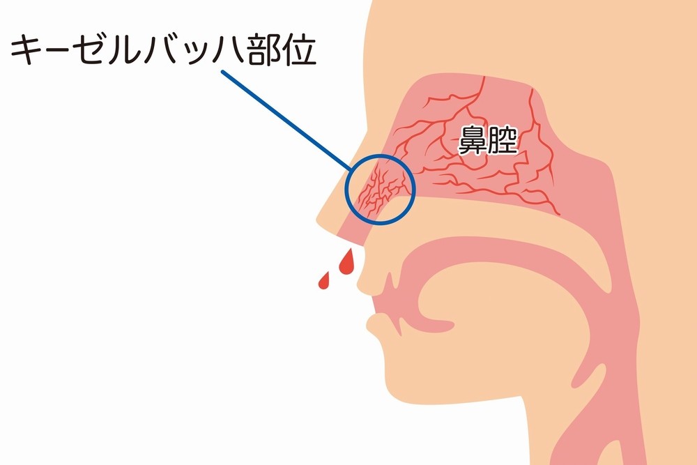 鼻のキーセルバッハ部位を指している図解